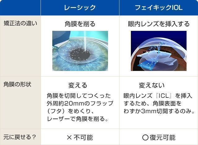 フェイキックIOL