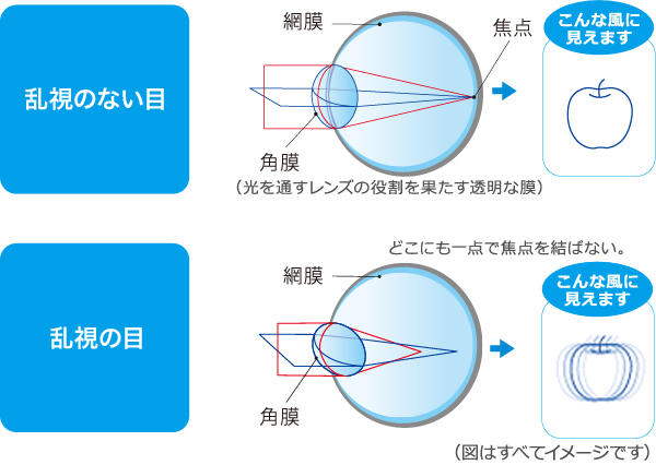 乱視の仕組み