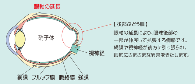 眼底の状態異常