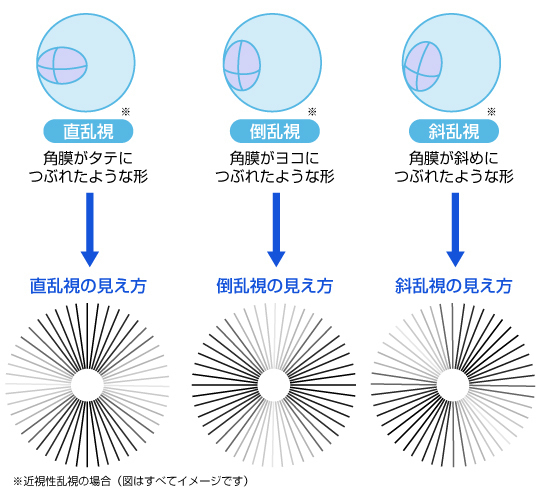 乱視の度数