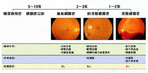 糖尿病性網膜症
