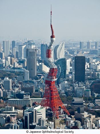 黄斑に変性を来した時の見え方