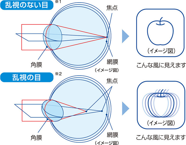 乱視とは